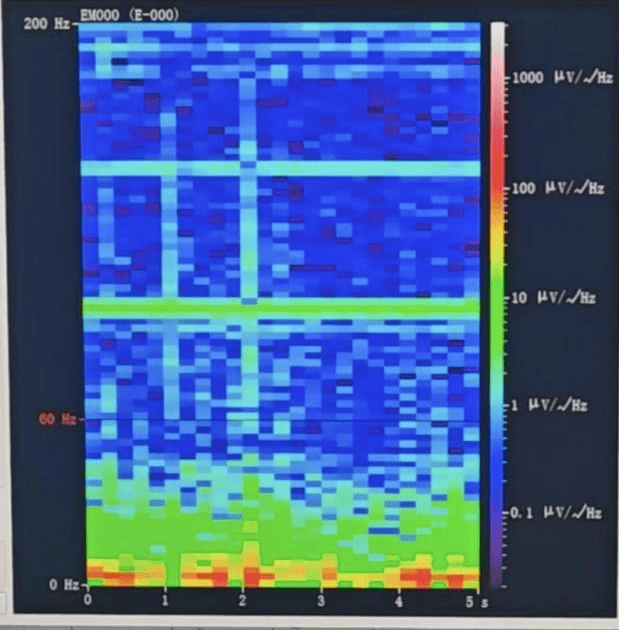 hga025怎么登录
_山西首例hga025怎么登录
!山西省人民医院成功实施脑机接口辅助功能区脑肿瘤切除手术