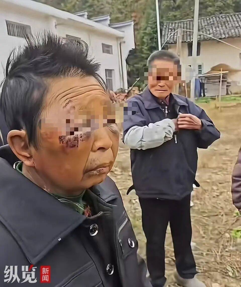 皇冠信用网开号
_湖南一女子被75岁丈夫酒后两次家暴皇冠信用网开号
,村民:女子被打从不还手,男子动手不是一次两次