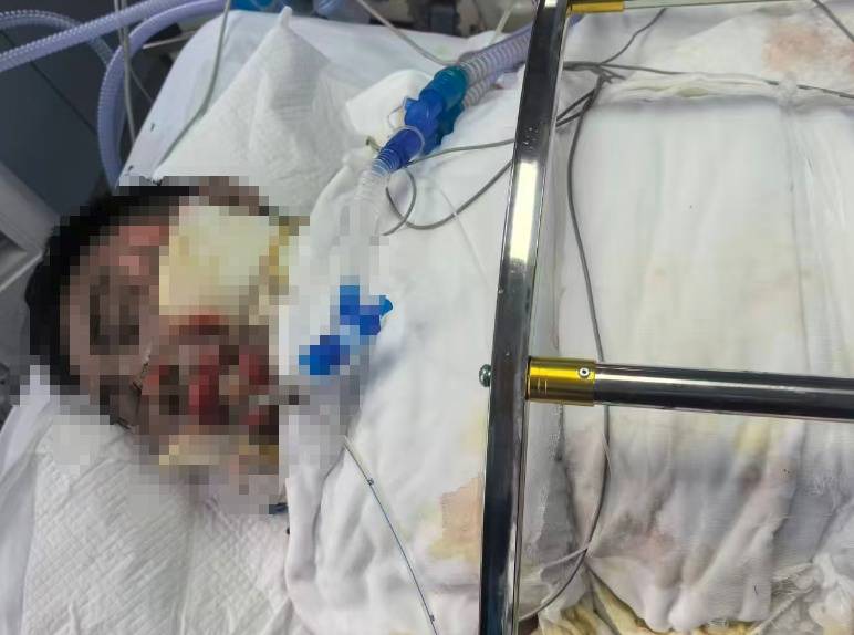 NBA美国职业篮球联赛
_滚烫的水NBA美国职业篮球联赛
，从头流到脚！今晚洗澡前紧急提醒！