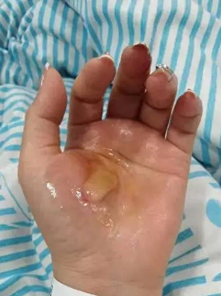 NBA美国职业篮球联赛
_滚烫的水NBA美国职业篮球联赛
，从头流到脚！今晚洗澡前紧急提醒！