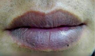 皇冠信用网登2_“感谢救我一命”32岁博主嘴唇发紫被粉丝催检查皇冠信用网登2，背上动态检测仪心脏停搏2次，最长3.1秒，医生：很危险，停搏不启动就叫猝死